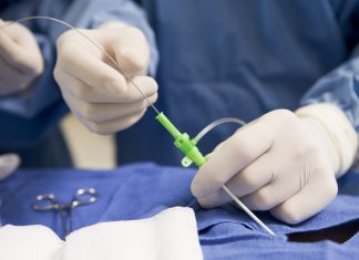 Intra-arterial Trombolisis, Masih Ada Tempatkah?
