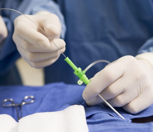 Intra-arterial Trombolisis, Masih Ada Tempatkah?
