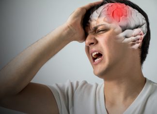 Sejarah Perkembangan Diagnosis Dan Terapi Stroke Iskemik