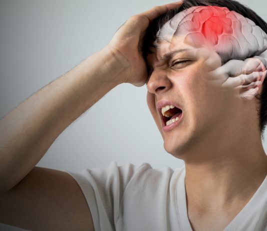 Sejarah Perkembangan Diagnosis Dan Terapi Stroke Iskemik